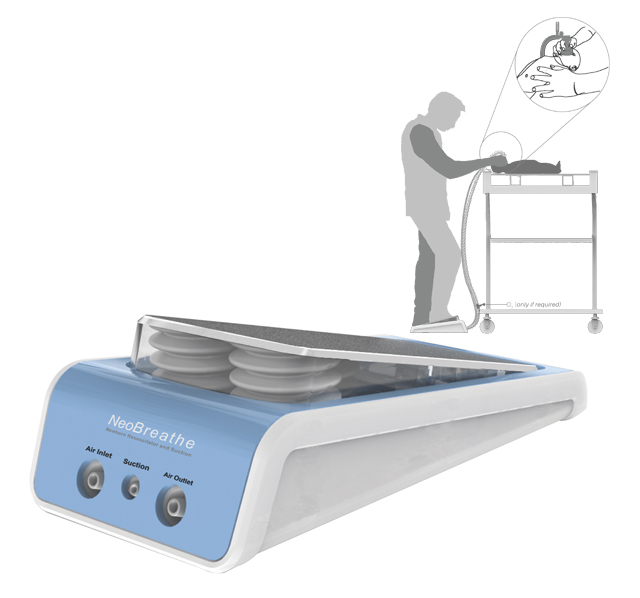 NeoBreathe ชุดกู้ชีพทารกทำงานได้คนเดียว